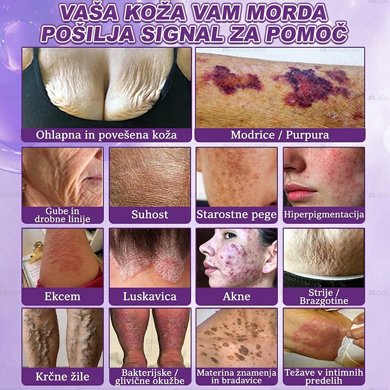 🐚Izdelano in poslano iz Evrope ✨ 𝐆𝐎𝐋𝐃𝐊𝐈𝐒𝐒® 𝐆𝐇𝐊-𝐂𝐮 & 𝐁𝐈𝐎𝐓𝐈𝐍 𝟏𝟎-𝐁-𝟏 Obnavljajoča krema za kožo