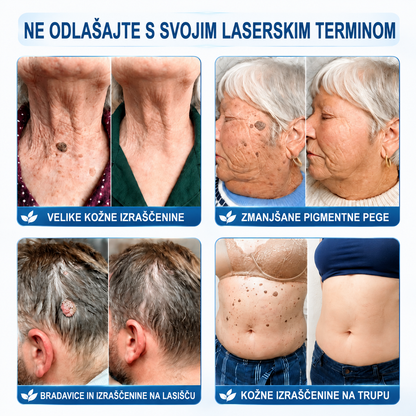 HISKIN® 🎁🎁🎁 Na voljo je le še 10 paketov! Zagotovite si dodatnih 50 % popusta! Ne zamudite te ponudbe, saj bo naslednja priložnost šele prihodnje leto.