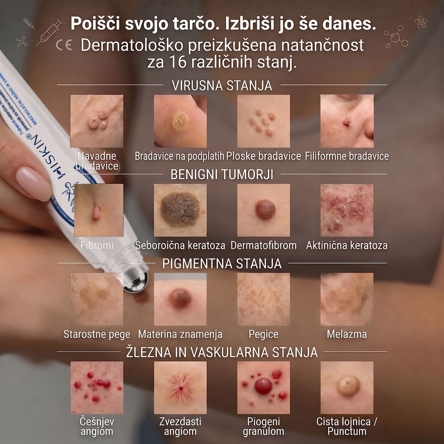 HISKIN® 🎁🎁🎁 Na voljo je le še 10 paketov! Zagotovite si dodatnih 50 % popusta! Ne zamudite te ponudbe, saj bo naslednja priložnost šele prihodnje leto.