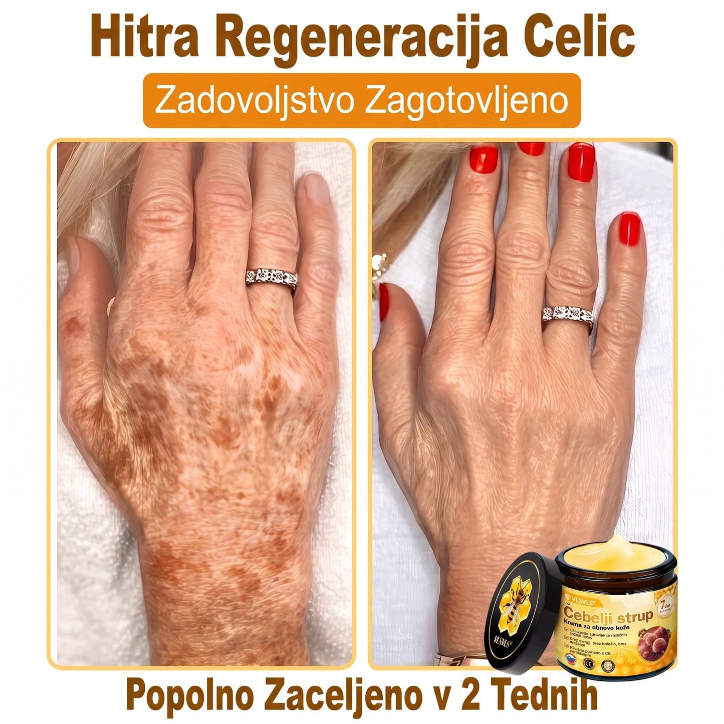 🎁🎁𝑽𝙇𝙎𝑽𝑳𝑺® Zadnja priložnost! Pridobite ga zdaj s 50 % popustom!