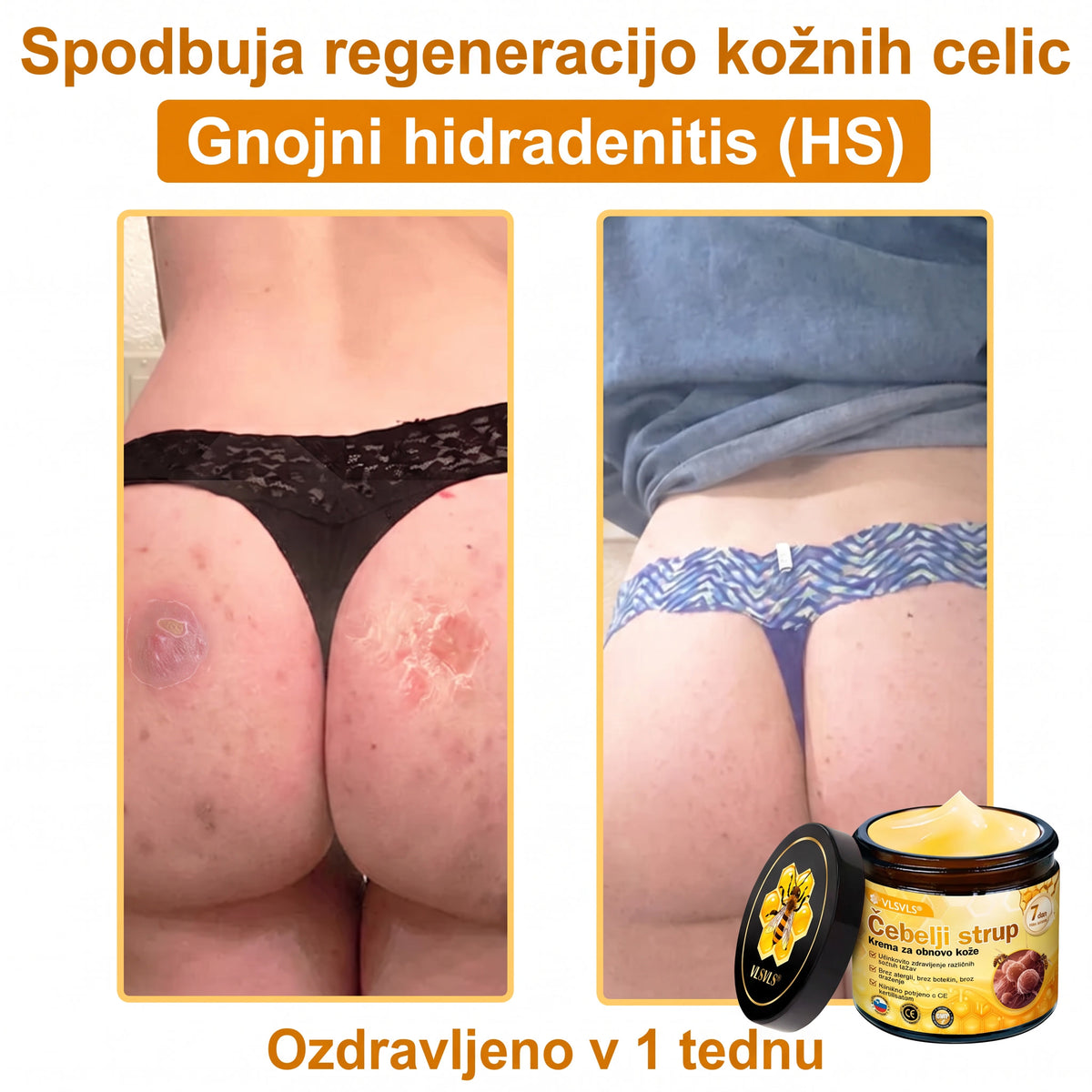 🎁🎁𝑽𝙇𝙎𝑽𝑳𝑺® Zadnja priložnost! Pridobite ga zdaj s 50 % popustom!