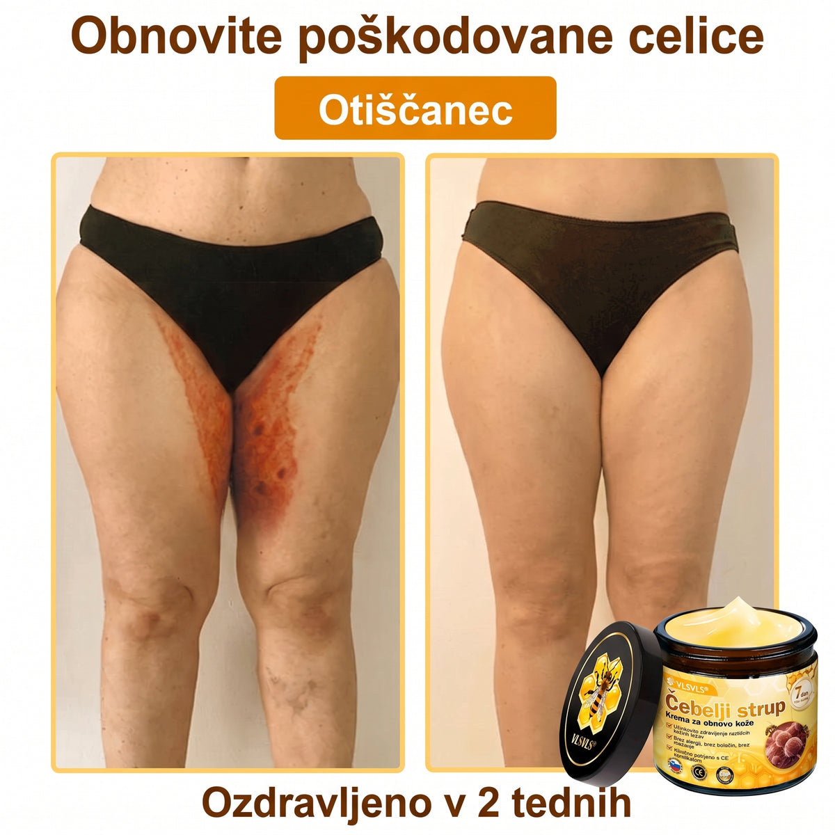 🎁🎁𝑽𝙇𝙎𝑽𝑳𝑺® Zadnja priložnost! Pridobite ga zdaj s 50 % popustom!