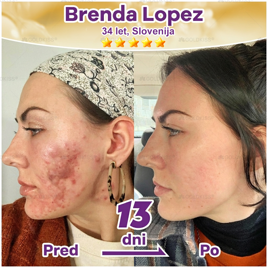 🐚Izdelano in poslano iz Evrope ✨ 𝐆𝐎𝐋𝐃𝐊𝐈𝐒𝐒® 𝐆𝐇𝐊-𝐂𝐮 & 𝐁𝐈𝐎𝐓𝐈𝐍 𝟏𝟎-𝐁-𝟏 Obnavljajoča krema za kožo