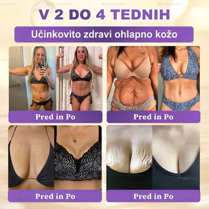 🐚Izdelano in poslano iz Evrope ✨ 𝐆𝐎𝐋𝐃𝐊𝐈𝐒𝐒® 𝐆𝐇𝐊-𝐂𝐮 & 𝐁𝐈𝐎𝐓𝐈𝐍 𝟏𝟎-𝐁-𝟏 Obnavljajoča krema za kožo