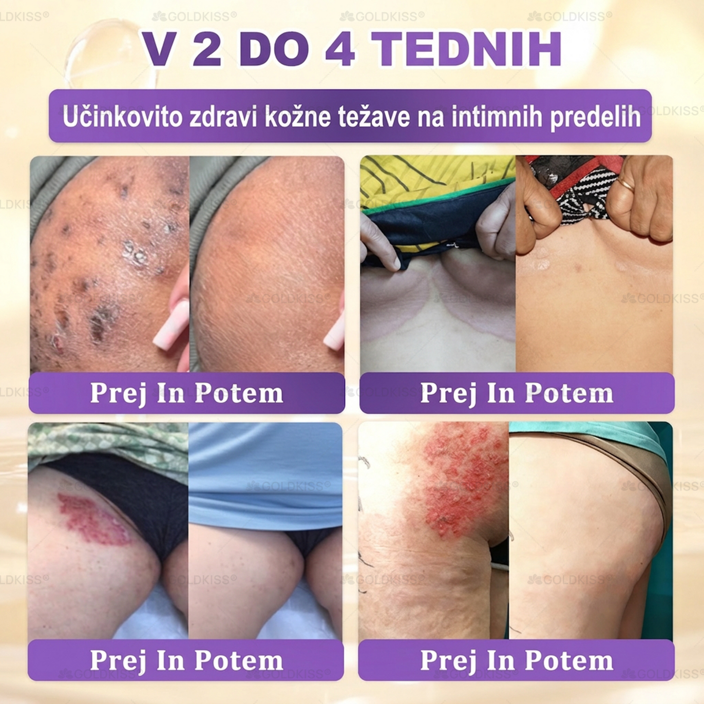 🐚Izdelano in poslano iz Evrope ✨ 𝐆𝐎𝐋𝐃𝐊𝐈𝐒𝐒® 𝐆𝐇𝐊-𝐂𝐮 & 𝐁𝐈𝐎𝐓𝐈𝐍 𝟏𝟎-𝐁-𝟏 Obnavljajoča krema za kožo