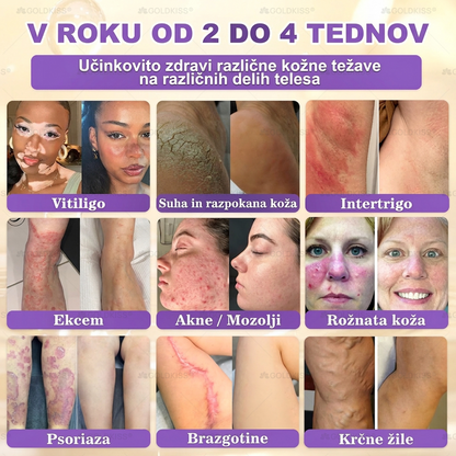 🐚Izdelano in poslano iz Evrope ✨ 𝐆𝐎𝐋𝐃𝐊𝐈𝐒𝐒® 𝐆𝐇𝐊-𝐂𝐮 & 𝐁𝐈𝐎𝐓𝐈𝐍 𝟏𝟎-𝐁-𝟏 Obnavljajoča krema za kožo