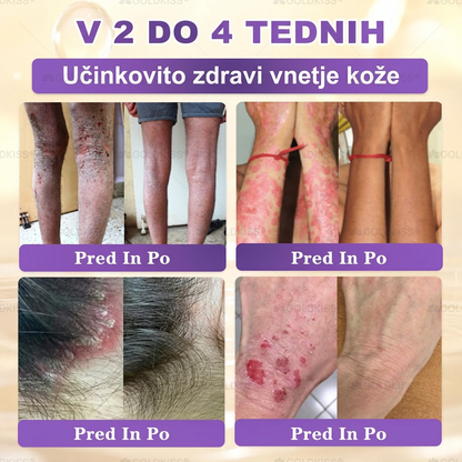 🐚Izdelano in poslano iz Evrope ✨ 𝐆𝐎𝐋𝐃𝐊𝐈𝐒𝐒® 𝐆𝐇𝐊-𝐂𝐮 & 𝐁𝐈𝐎𝐓𝐈𝐍 𝟏𝟎-𝐁-𝟏 Obnavljajoča krema za kožo