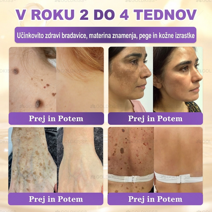🐚Izdelano in poslano iz Evrope ✨ 𝐆𝐎𝐋𝐃𝐊𝐈𝐒𝐒® 𝐆𝐇𝐊-𝐂𝐮 & 𝐁𝐈𝐎𝐓𝐈𝐍 𝟏𝟎-𝐁-𝟏 Obnavljajoča krema za kožo