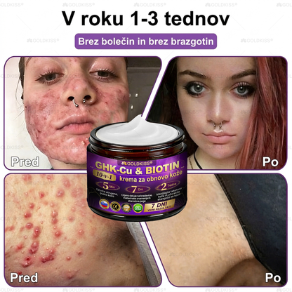 🐚Izdelano in poslano iz Evrope ✨ 𝐆𝐎𝐋𝐃𝐊𝐈𝐒𝐒® 𝐆𝐇𝐊-𝐂𝐮 & 𝐁𝐈𝐎𝐓𝐈𝐍 𝟏𝟎-𝐁-𝟏 Obnavljajoča krema za kožo