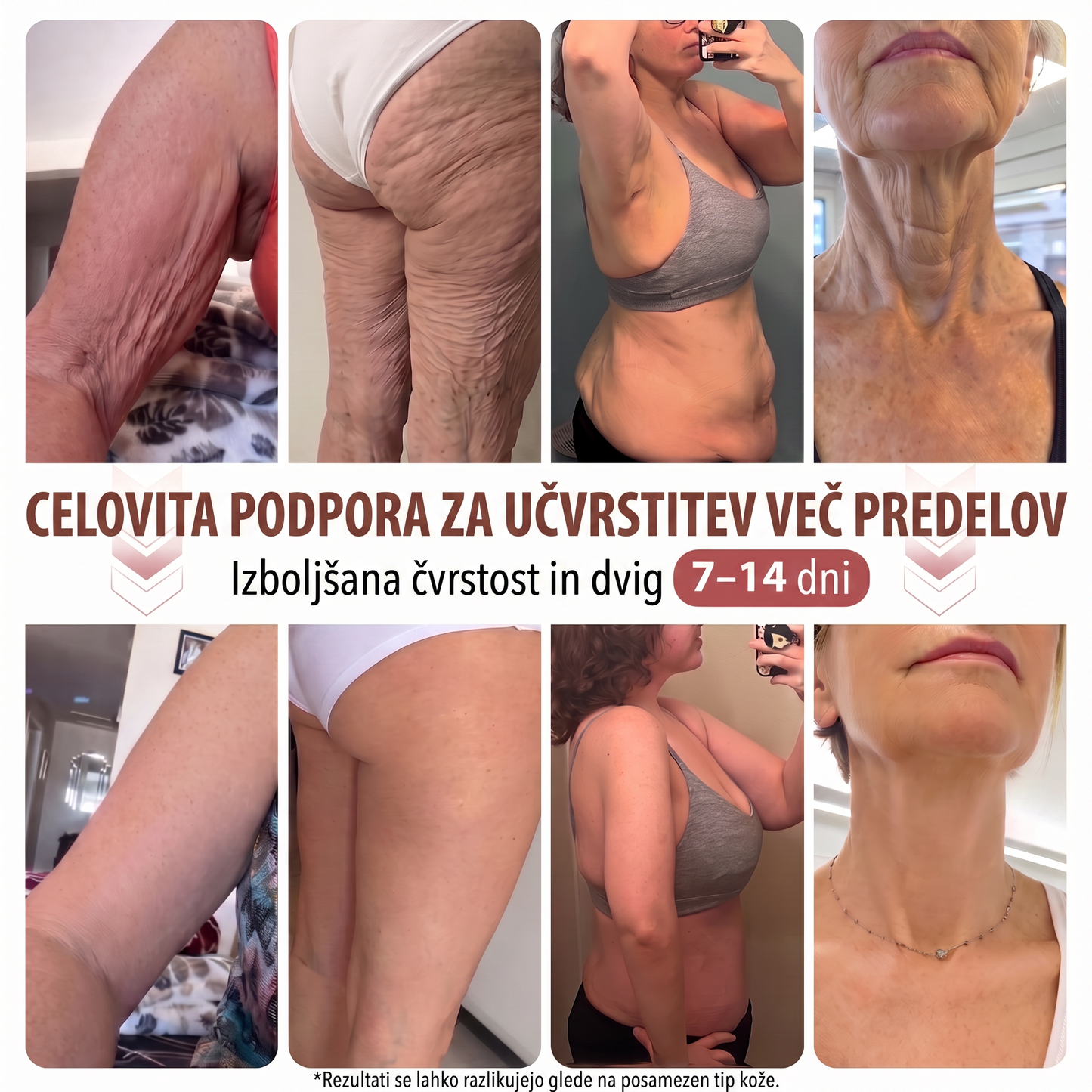 HISKIN® 🎁🎁🎁 Na voljo je le še 10 paketov! Zagotovite si dodatnih 50 % popusta! Ne zamudite te ponudbe, saj bo naslednja priložnost šele prihodnje leto.